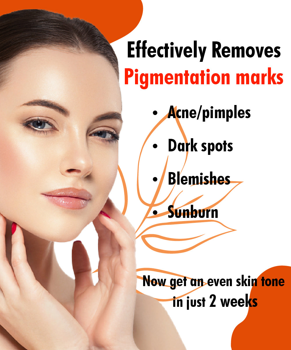 Urban Yog Anti-Pigmentation Serum removes pigmentation marks - UrbanYog