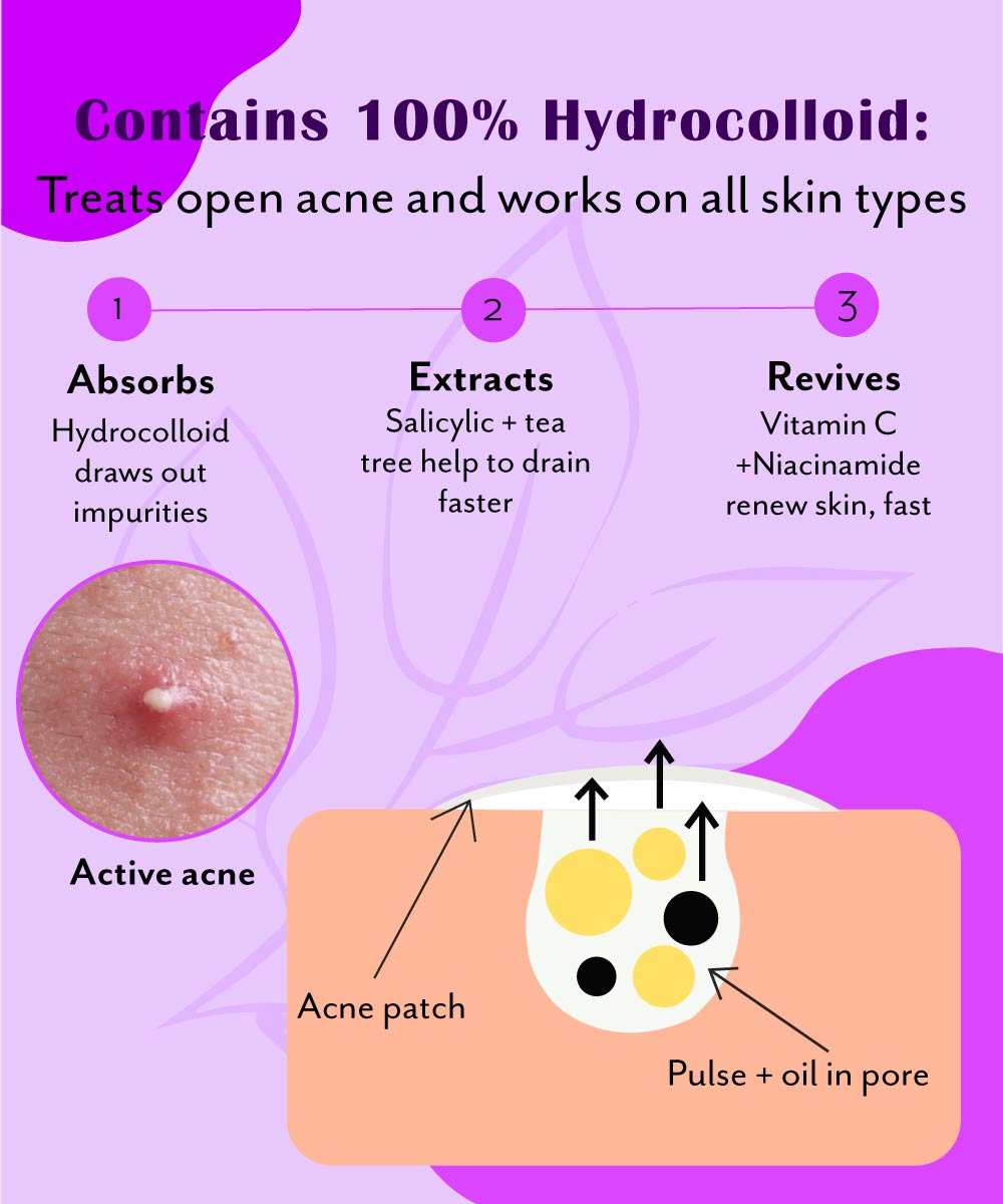 Urban Yog Curvy Pimple Patch contains Hydrocolloid - Urban Yog