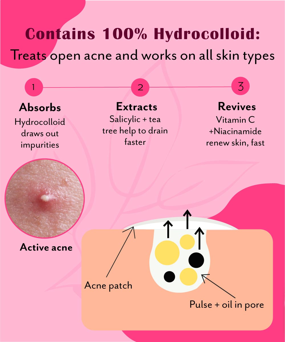 Urban Yog Rectangular Pimple Patch contains Hydrocolloid - Urban Yog